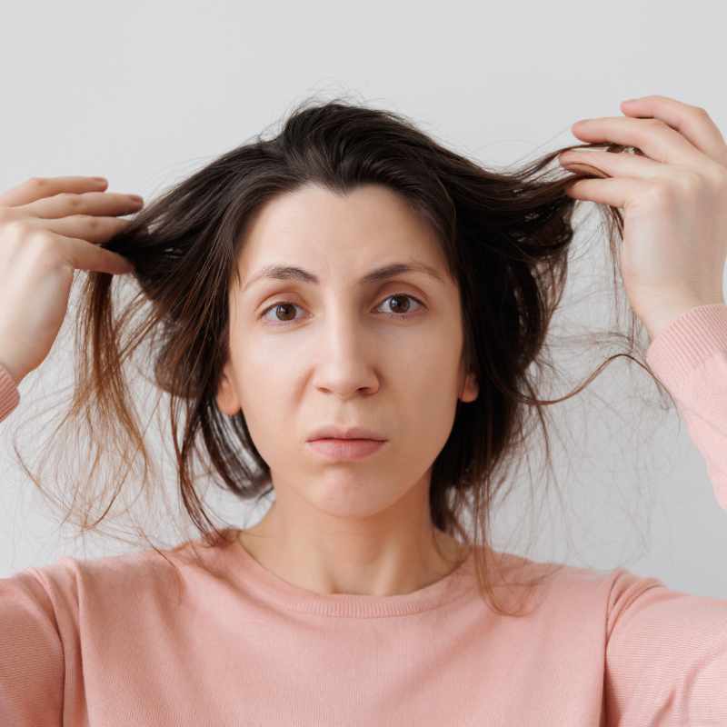 dry-hair-problems dry-hair-problems