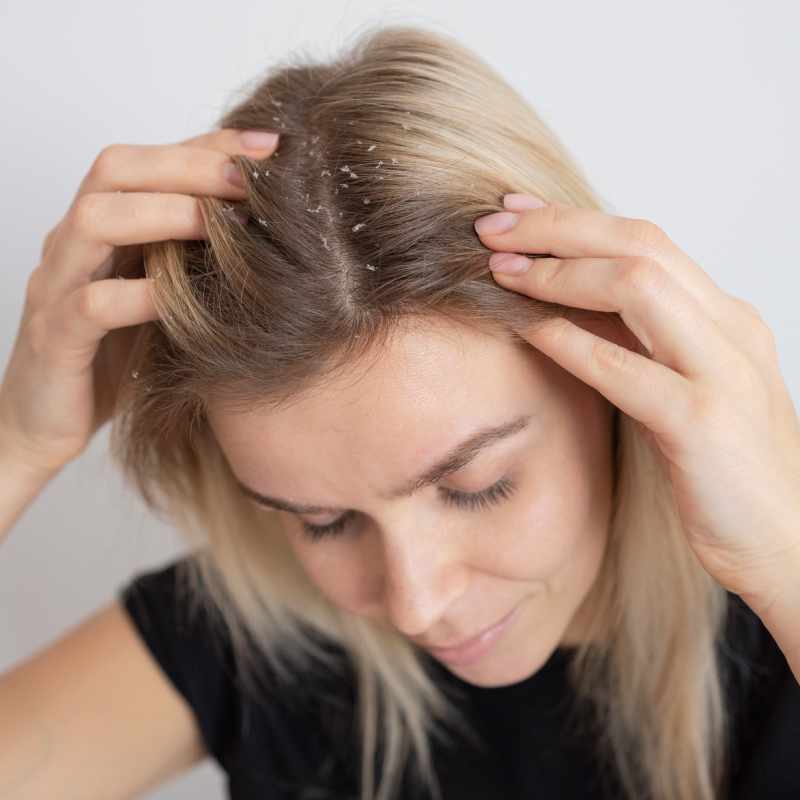 scalp-problems scalp-problems